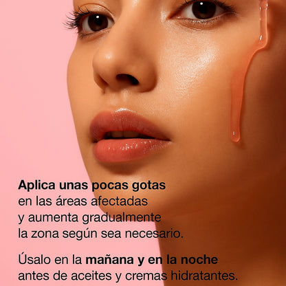 ANUA Sérum Despigmentante Niacinamide 10% + Txa 4% (30 ml)