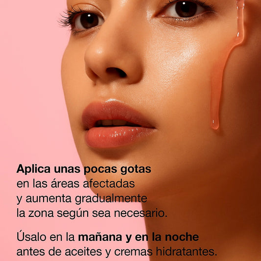 ANUA Sérum Despigmentante Niacinamide 10% + Txa 4% (30 ml)
